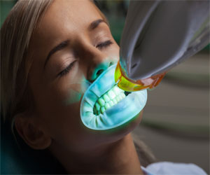 teeth whitening kensington