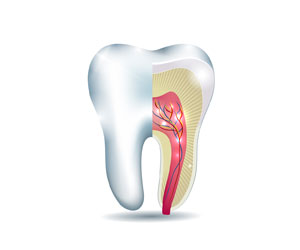 root canal london kensington