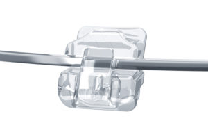 DClear-Bracket-Wire