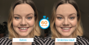 See what Your Teeth Would Look Like In 60 Seconds