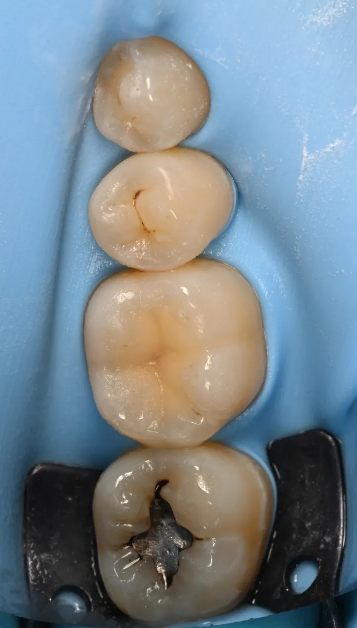 Before, During & After
