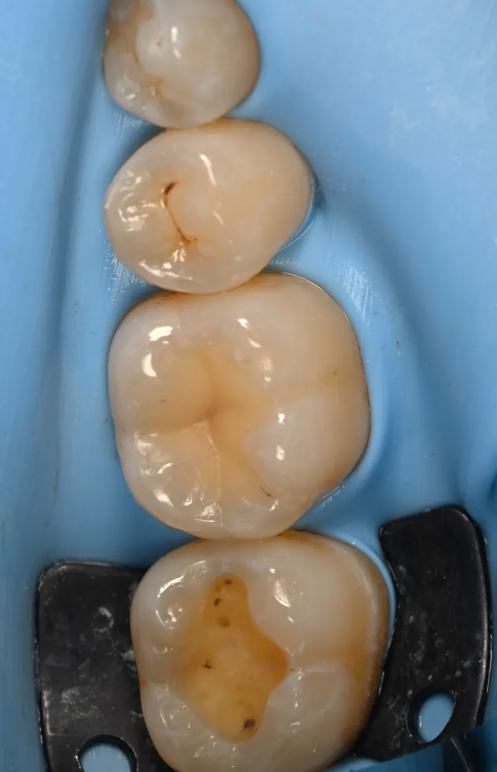 Before, During & After